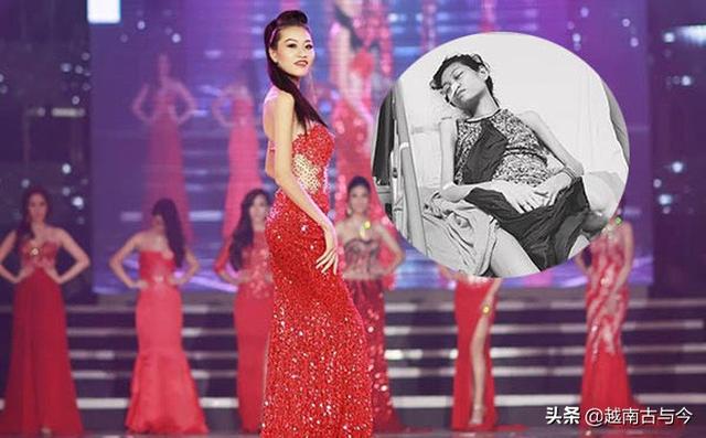 越南嫩模年纪轻轻被癌症折磨，病重中美女变成皮包骨，后痛苦死去