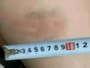 抽美女(全班被打体育女教师挨个抽打54名学生，有人伤痕达10厘米)