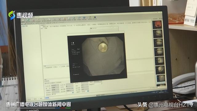 这种好奇要不得!小伙将12公分铜条“塞进”体内 差点扎破肠子