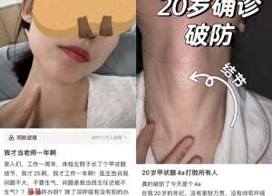 美女自己摸自己的胸的视频(95后姑娘得了这种病，每天摸800遍脖子感觉被判无期徒刑)