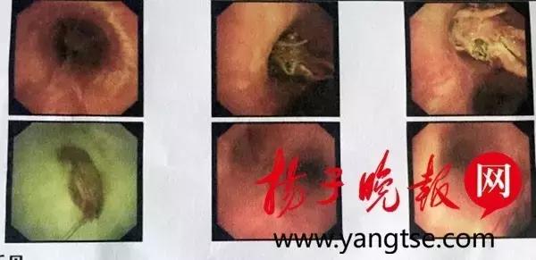 小龙虾真是最没有尊严的入侵物种了 TOP神评榜