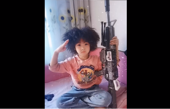为什么有人天生爆炸头？原来是“蓬发综合征”