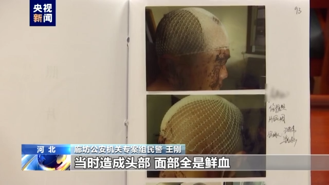 唐山打人案被害人发声!警方讯问陈某志现场视频首次曝光
