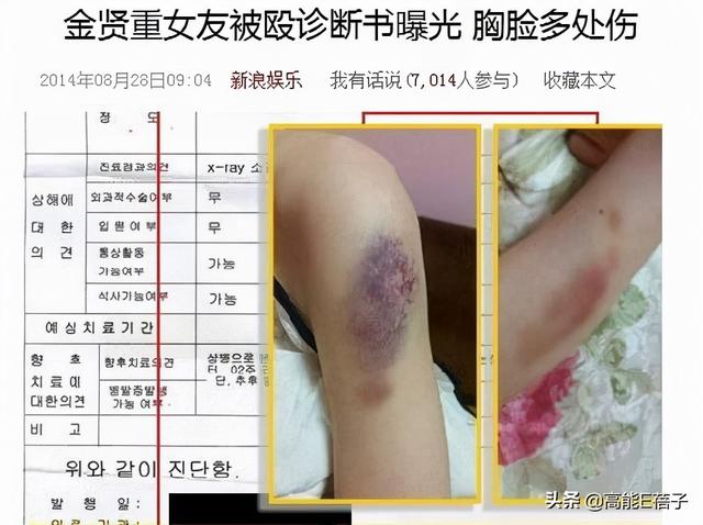 35岁金贤重宣布结婚,曾因前女友诬陷家暴致流产事业尽毁