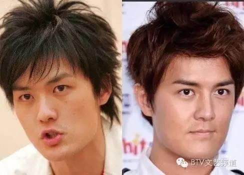 打死也不承认！那些娱乐圈整容到面瘫的男星