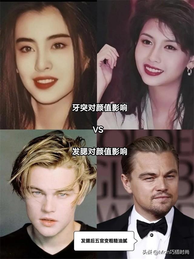 牙突不算什么,“发腮”才是真的拉垮,显凶又老态,太多人遭殃了