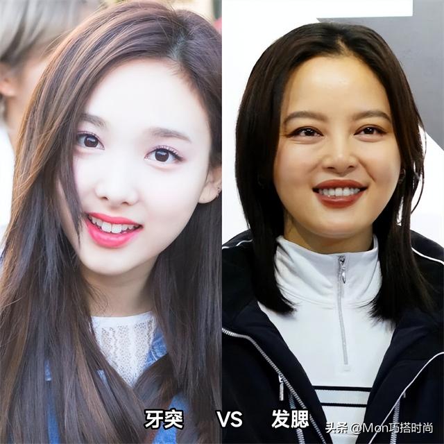 牙突不算什么,“发腮”才是真的拉垮,显凶又老态,太多人遭殃了
