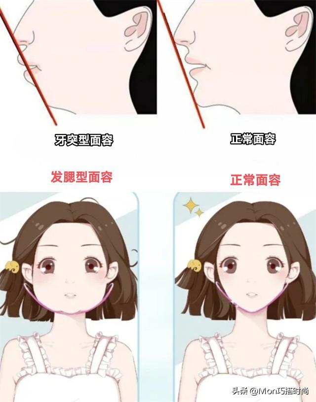 牙突不算什么,“发腮”才是真的拉垮,显凶又老态,太多人遭殃了