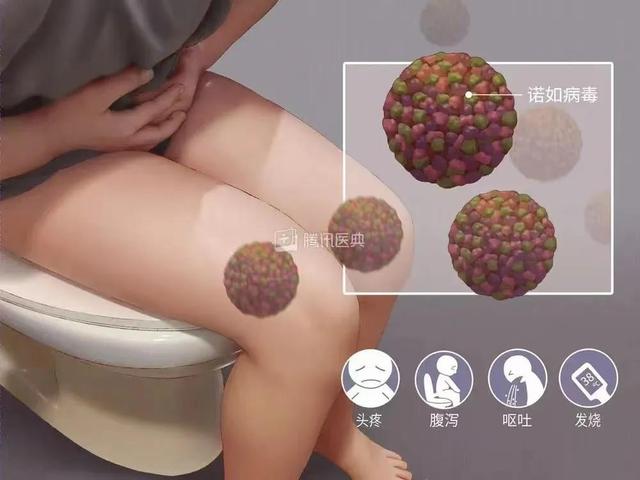 注意!这种病毒传染性强,易在学校集中暴发……