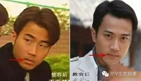 打死也不承认！那些娱乐圈整容到面瘫的男星