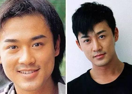打死也不承认！那些娱乐圈整容到面瘫的男星