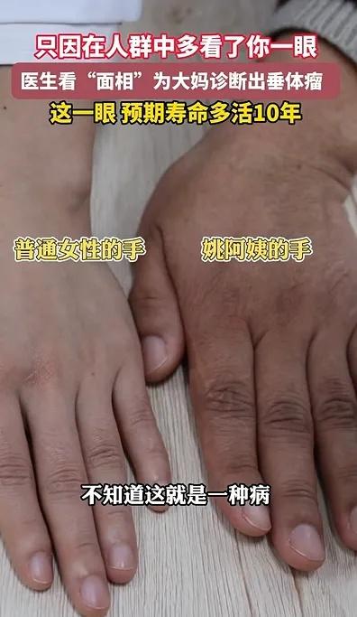 男子陪妻看病,医生见面就说:她不是你才是!