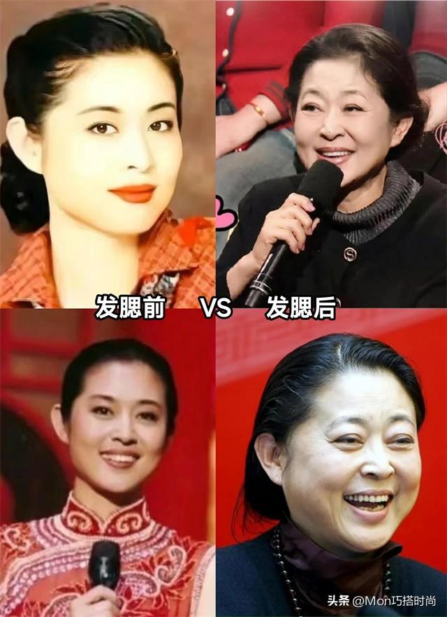 牙突不算什么,“发腮”才是真的拉垮,显凶又老态,太多人遭殃了