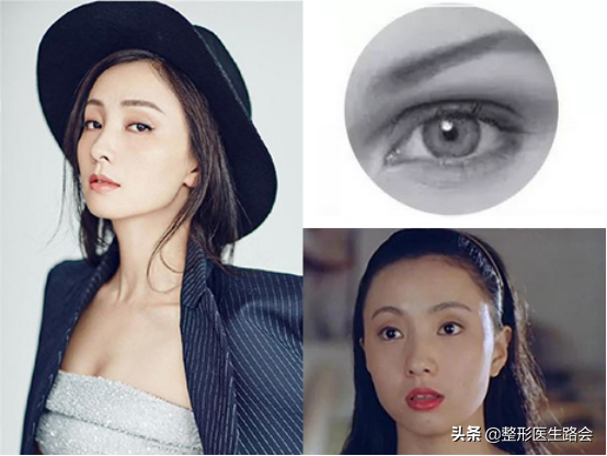 周冬雨的眼睛里有故事,好看的双眼皮让她变了一个人