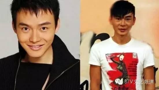 打死也不承认！那些娱乐圈整容到面瘫的男星