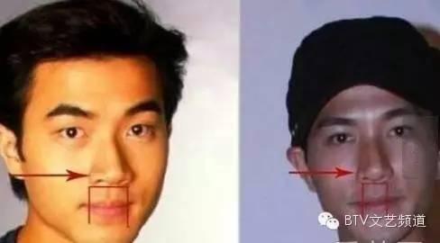 打死也不承认！那些娱乐圈整容到面瘫的男星