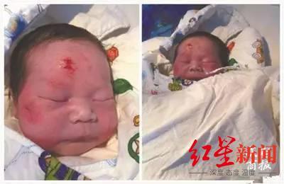 厦门车祸“奇迹宝宝”满7岁:每年赴京复查停了,奶奶用60多万赔偿款买了保险