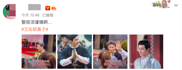 人气男星疑似整容失败!鼻子大到比例失调,传替肖战出演庆余年2