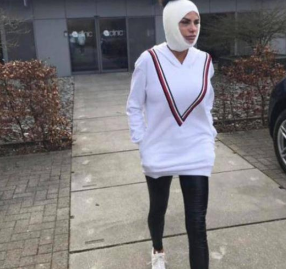 女模特整容失败变“僵尸脸”,从美女整容成了丑女,不敢出门见人