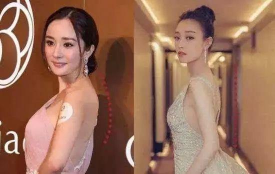 脖子前倾毁了无数人!除了最毁气质,健康危害也不少!