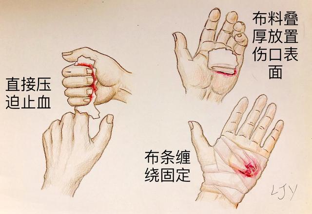 手被割伤了要紧吗:图解日常手部外伤