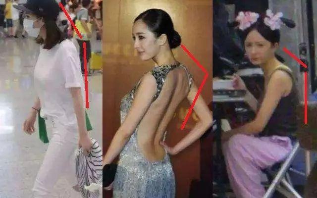 脖子前倾毁了无数人!除了最毁气质,健康危害也不少!