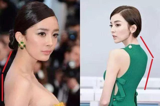 脖子前倾毁了无数人!除了最毁气质,健康危害也不少!
