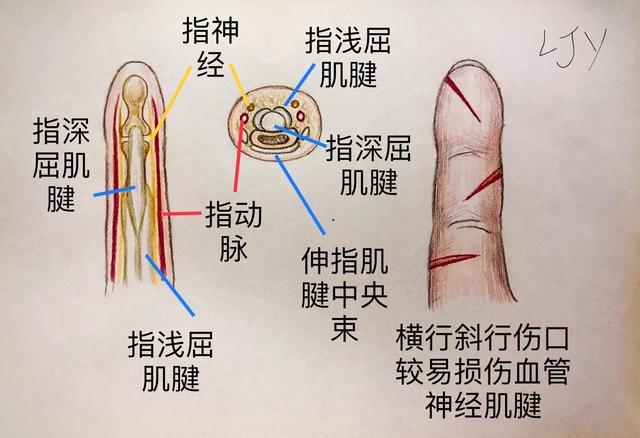 手被割伤了要紧吗:图解日常手部外伤