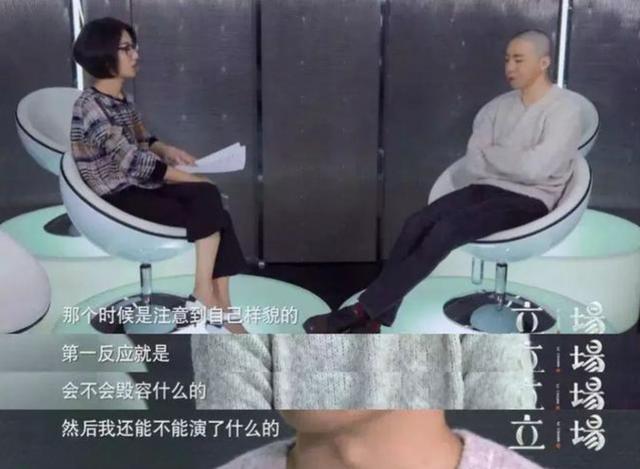 当昔日顶流失去偶像脸,毁容的他现在怎样了?