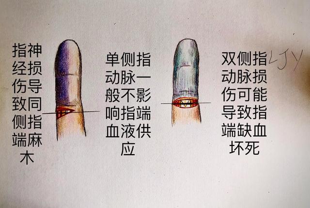 手被割伤了要紧吗:图解日常手部外伤