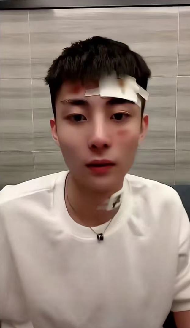 帅气网红自曝出车祸,对方酒驾肇事逃逸,头部腿部受伤流血缠绷带
