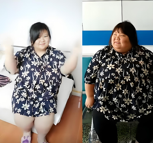 台州一枝花婚后被喂到330斤,过上摆烂生活,丈夫:我不准她减肥