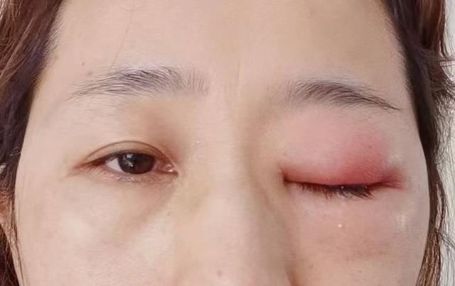 “相由心生”?心脏健康与否,脸上先知?这6种面部变化要注意了