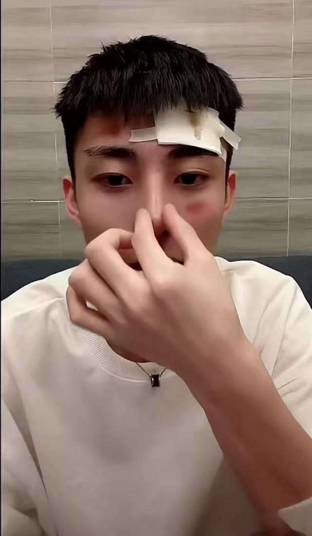 帅气网红自曝出车祸,对方酒驾肇事逃逸,头部腿部受伤流血缠绷带