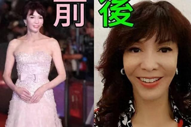 曾经也是美丽明艳,却因整容毁掉一切,这6位女星全是反面案例!