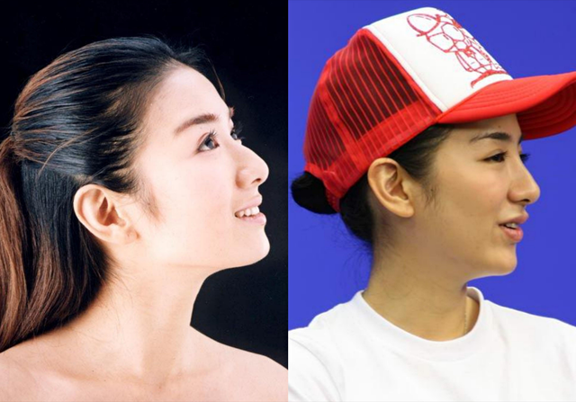曾经也是美丽明艳,却因整容毁掉一切,这6位女星全是反面案例!
