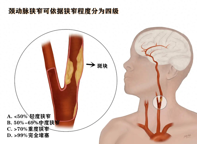 以下5种属于‘老年病’,无需过度治疗