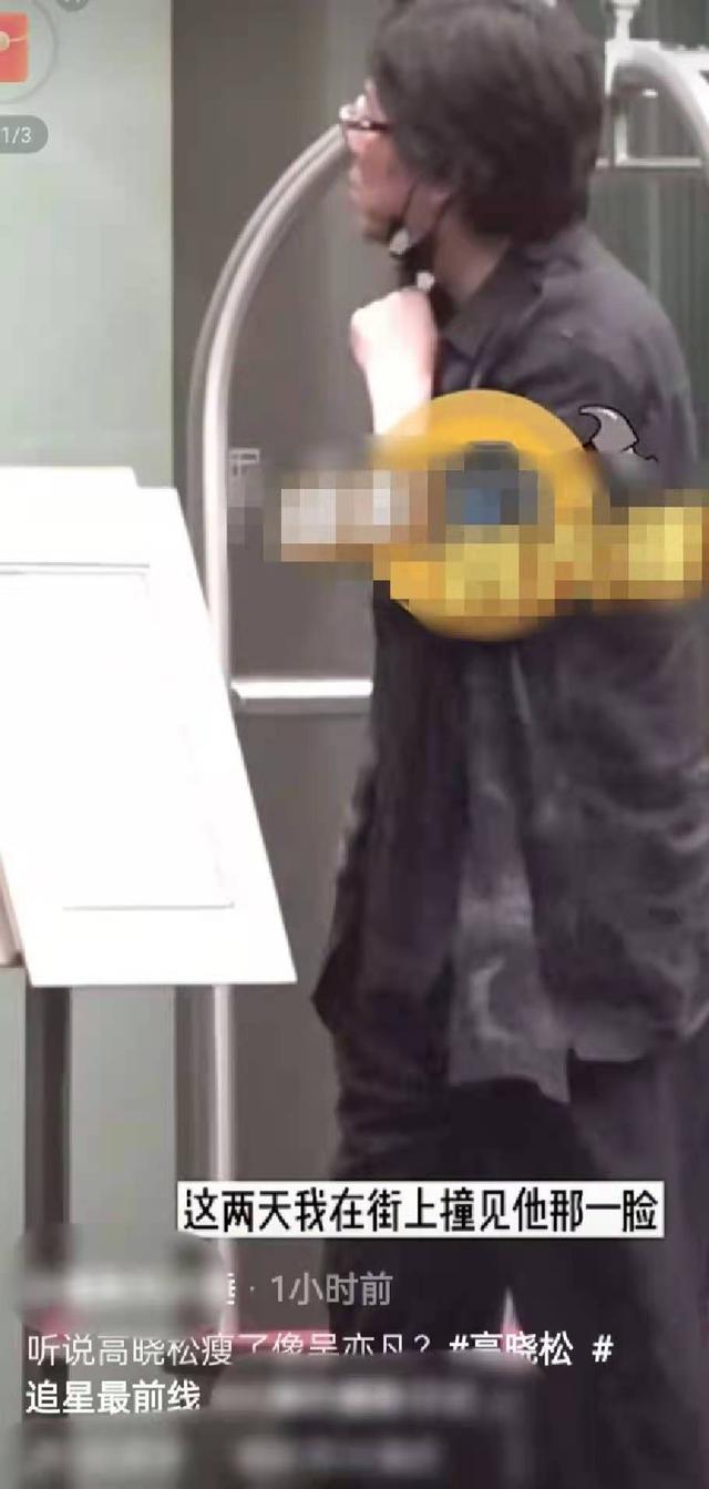 高晓松暴瘦26斤后现身街头,脸部松垮气色差,被指减肥后脱发严重