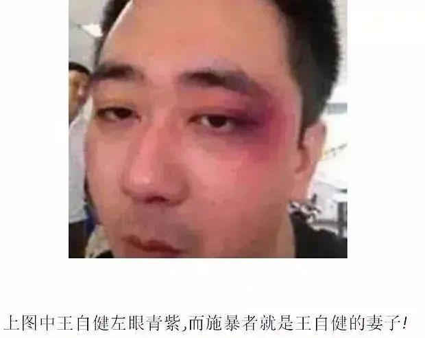 抑郁症好了,被章子怡夸了,可他到底有没有被家暴?