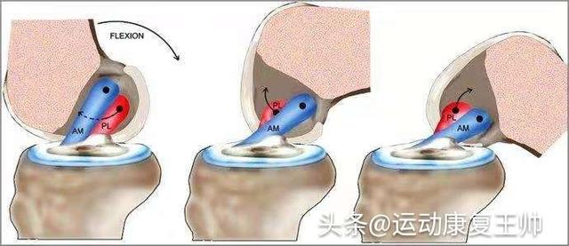 下肢术后康复,掰腿的并发症