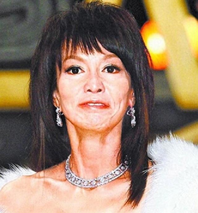 曾经也是美丽明艳,却因整容毁掉一切,这6位女星全是反面案例!