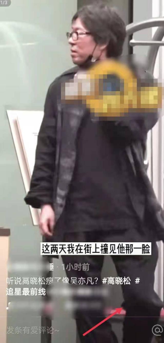 高晓松暴瘦26斤后现身街头,脸部松垮气色差,被指减肥后脱发严重