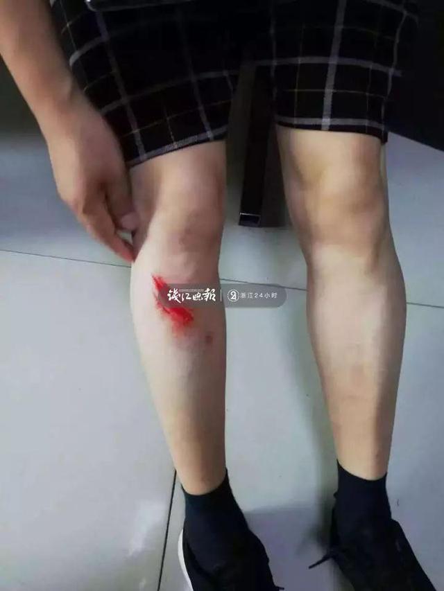 这张“不雅照”,走红了