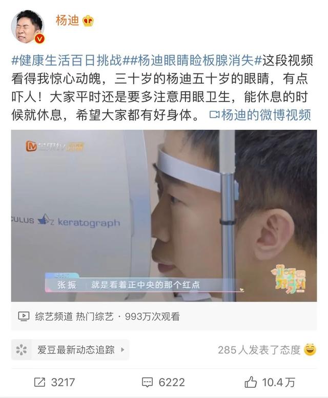 “30岁的杨迪50岁的眼睛!”网友直呼:不敢再天天做这事了