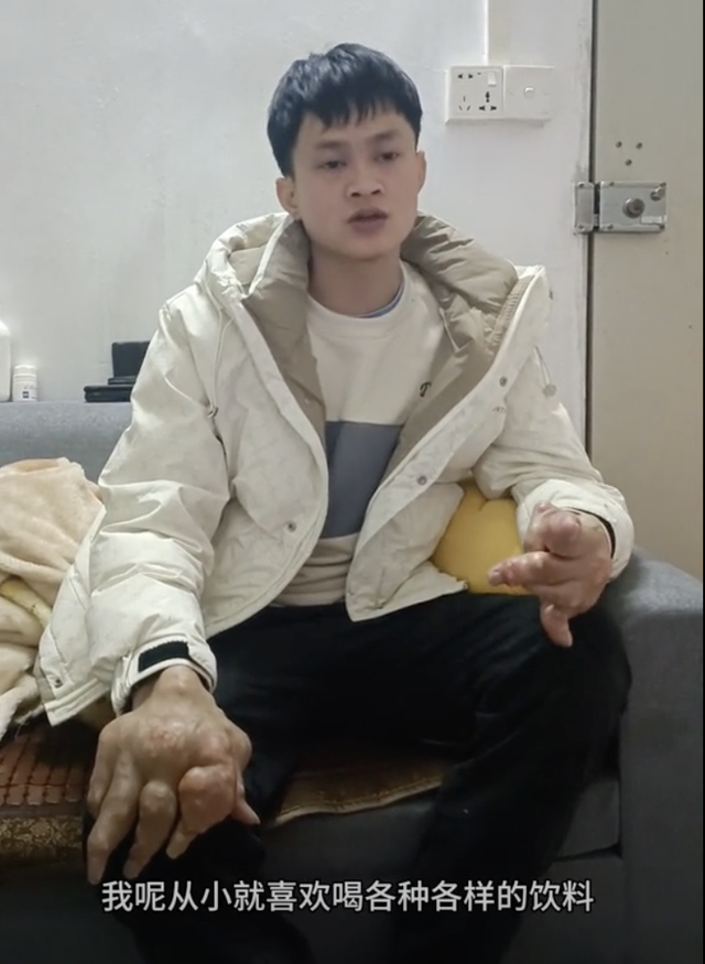 29岁小伙双手变形如“生姜”,此前知名男星疼得起不来床,这病逐渐年轻化…