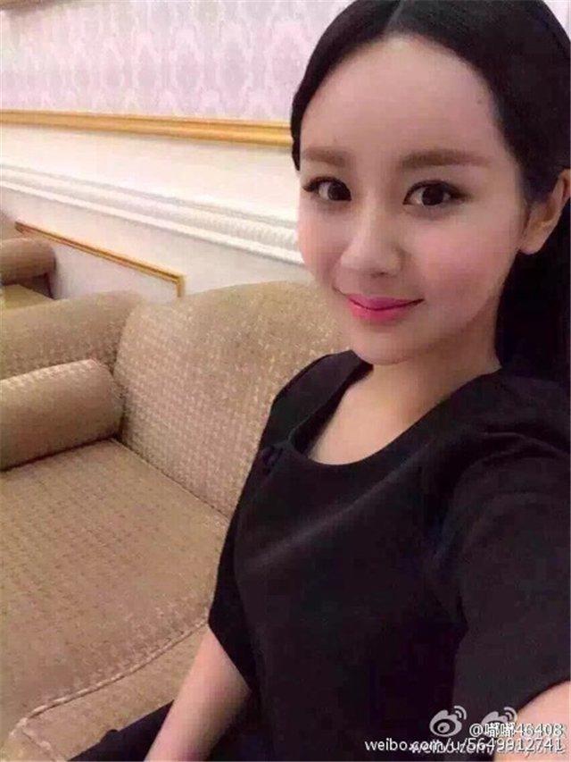 不会吧？杨紫因为整容过度额头的填充物都凸出来了吗？