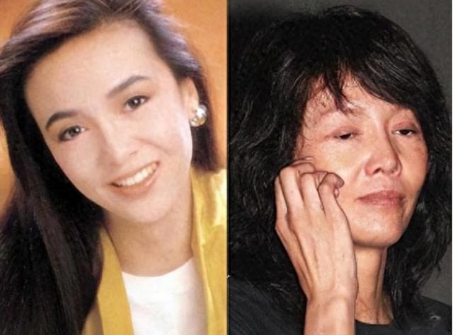 曾经也是美丽明艳,却因整容毁掉一切,这6位女星全是反面案例!