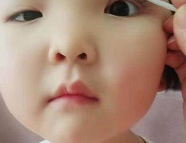 亲妈为了让六岁的女儿变美,亲自为娃“割双眼皮”,网友:心疼