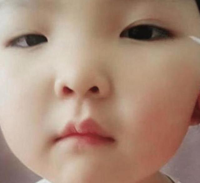 亲妈为了让六岁的女儿变美,亲自为娃“割双眼皮”,网友:心疼