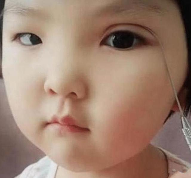 亲妈为了让六岁的女儿变美,亲自为娃“割双眼皮”,网友:心疼